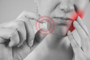 What to Expect When Getting Your Wisdom Tooth Removed